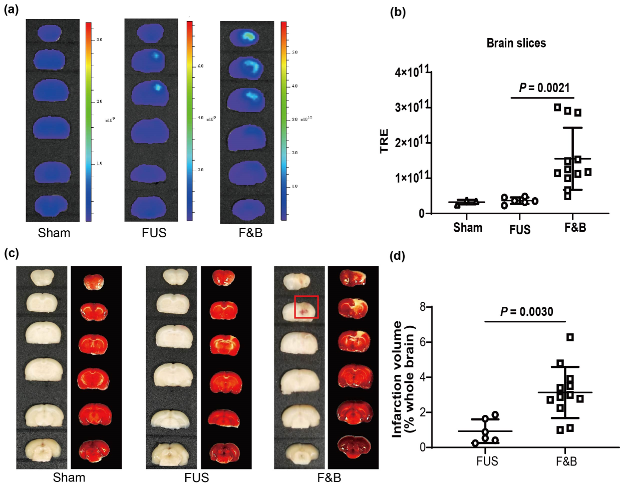 钧慧创新 | 联合聚焦超声与微泡制备大鼠脑出血模型的新方法